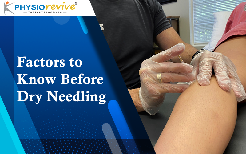 Factors to Know Before Dry Needling Physiorevive